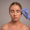 Blefaroplastyka