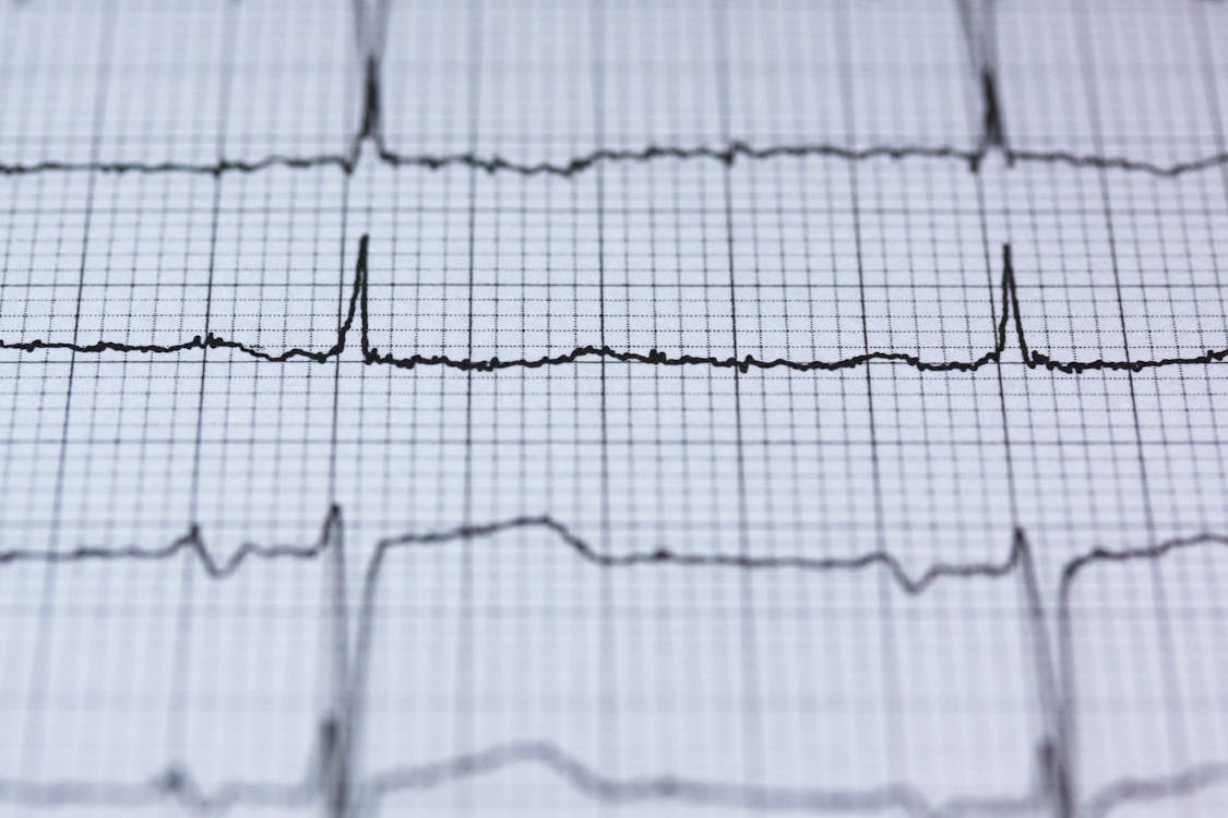 Read more about the article Co oznacza tatuaż pulsu serca? Jakie są jego symboliczne znaczenia?